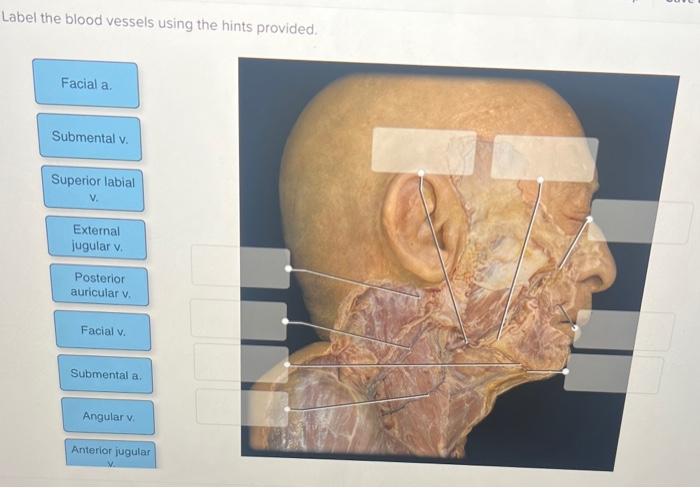 Solved head and neck layer 2label the blood vessels using | Chegg.com