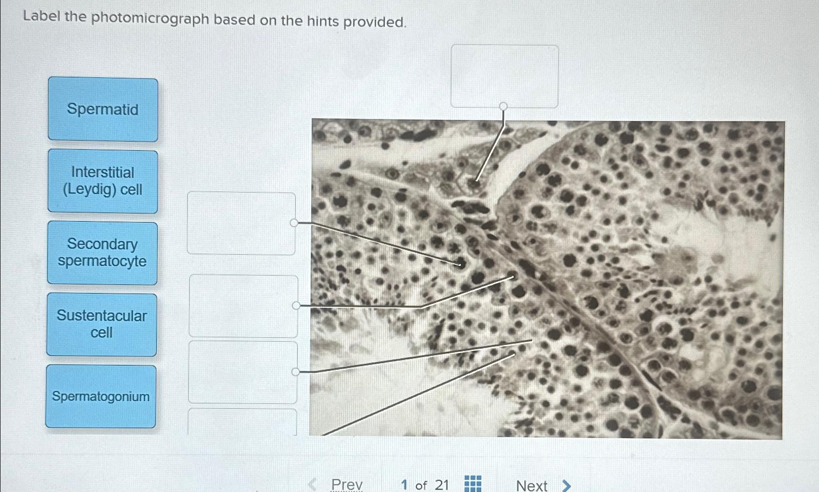 Solved Label the photomicrograph based on the hints | Chegg.com