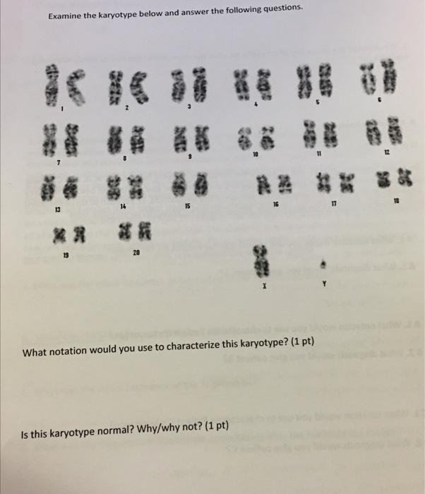 Solved Examine the karyotype below and answer the following | Chegg.com