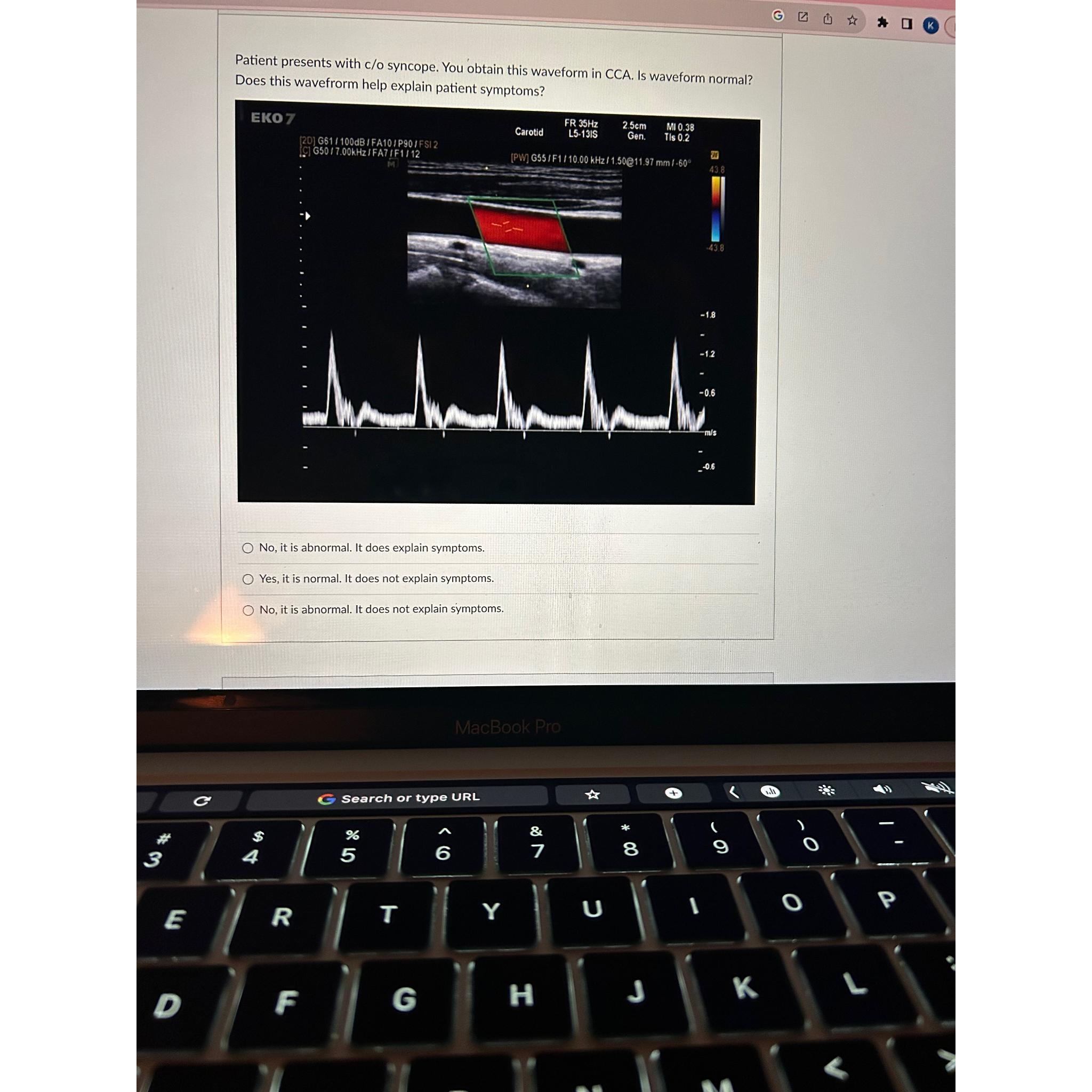 Solved Patient presents with c/o syncope. You obtain this