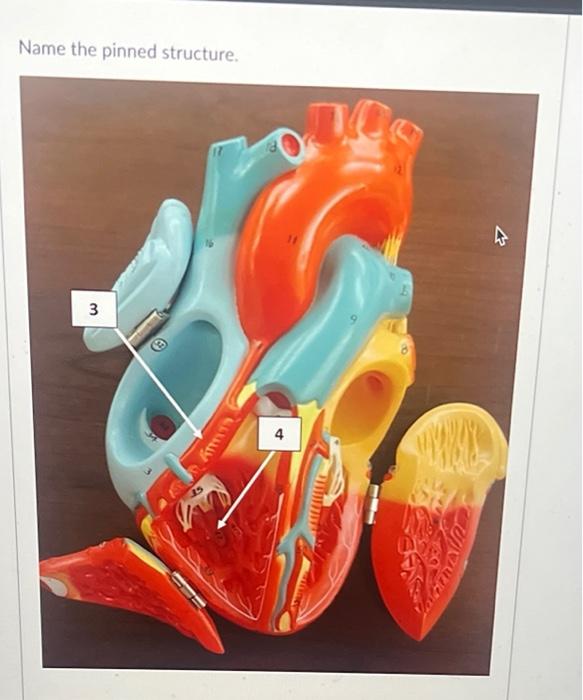 Solved Name the pinned structure. Pectinate Muscle