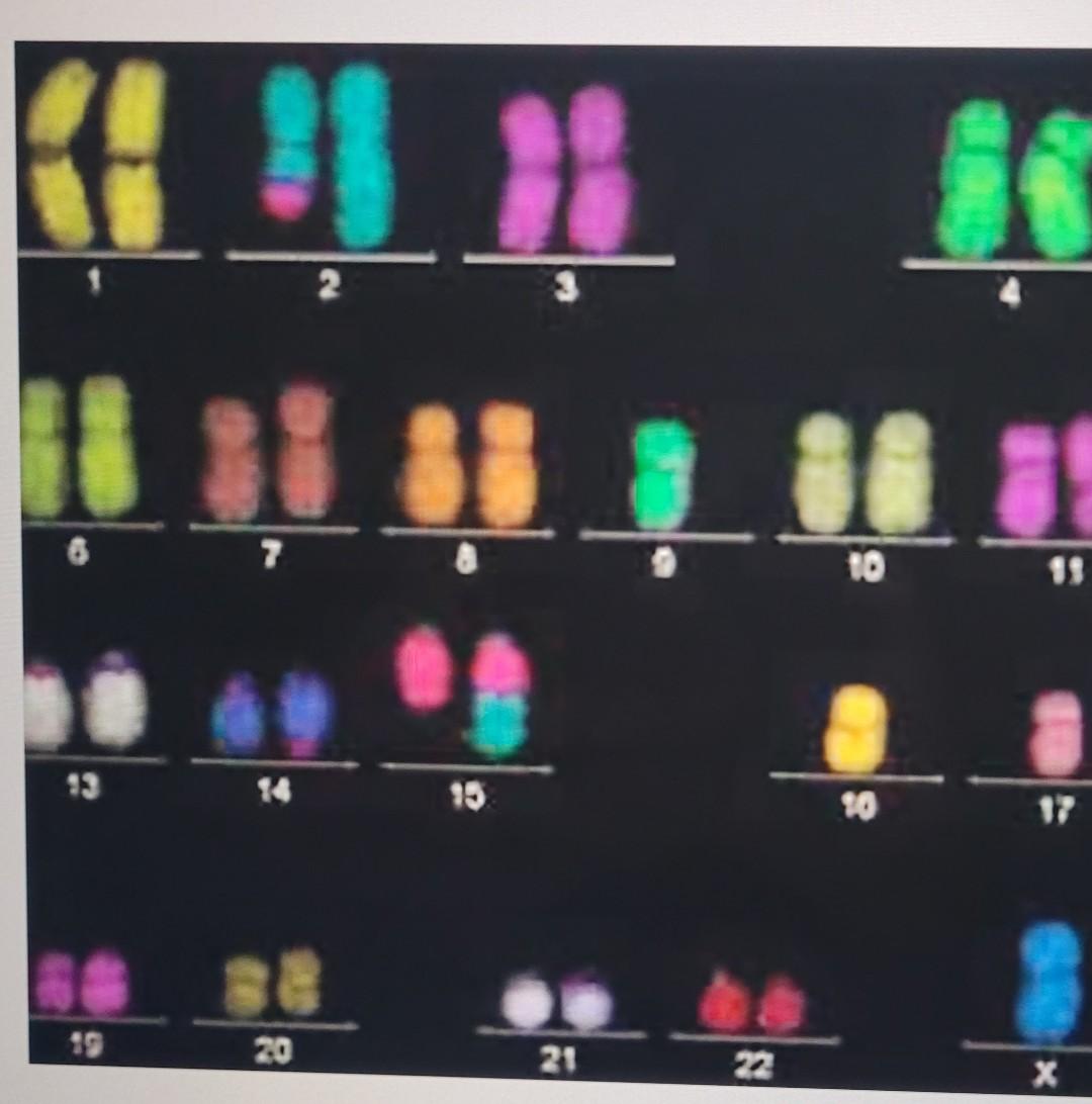 Solved All Three Questions 1. Look at the karyogram and | Chegg.com