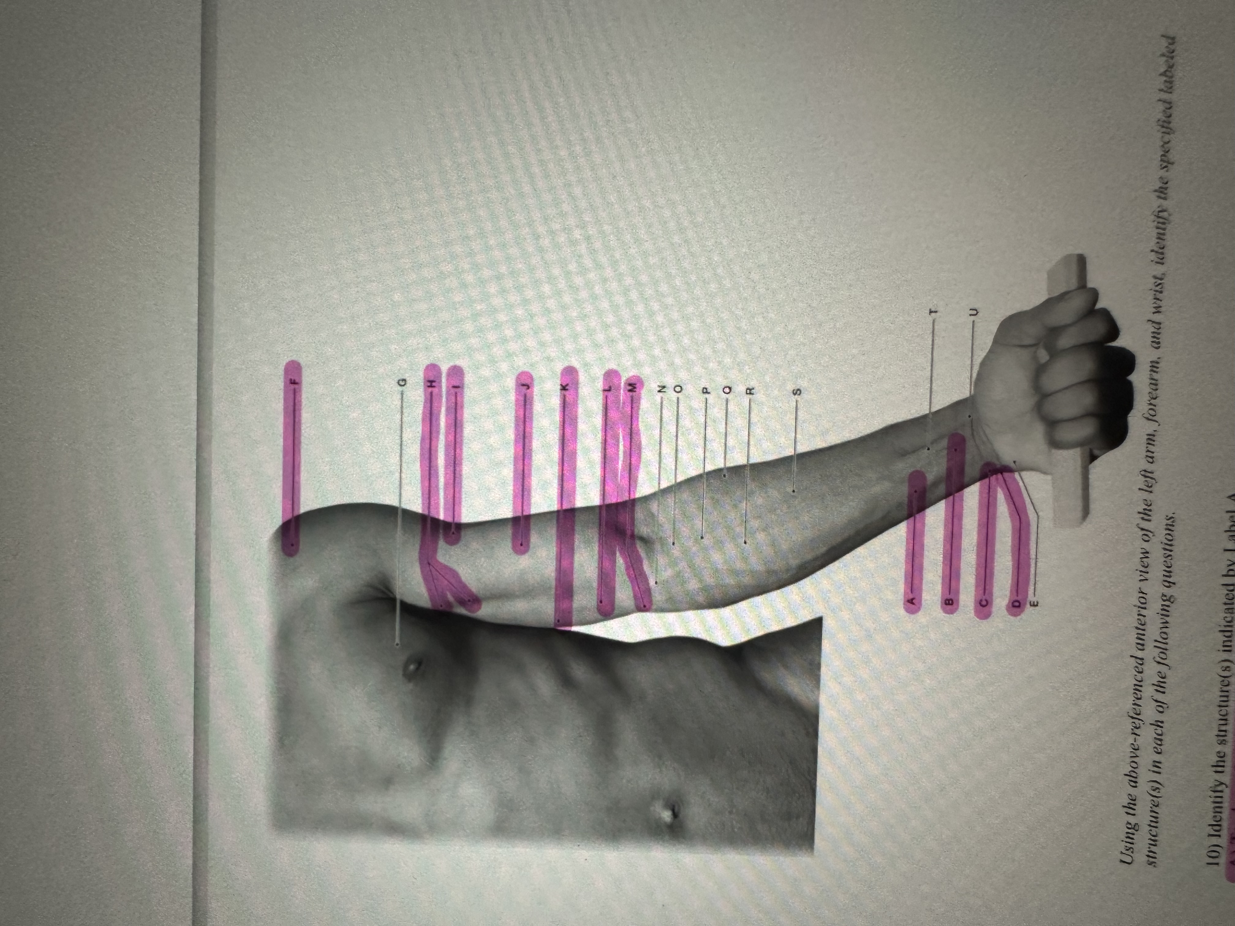 Identify the structure(s) ﻿indicated by Label B.A) | Chegg.com