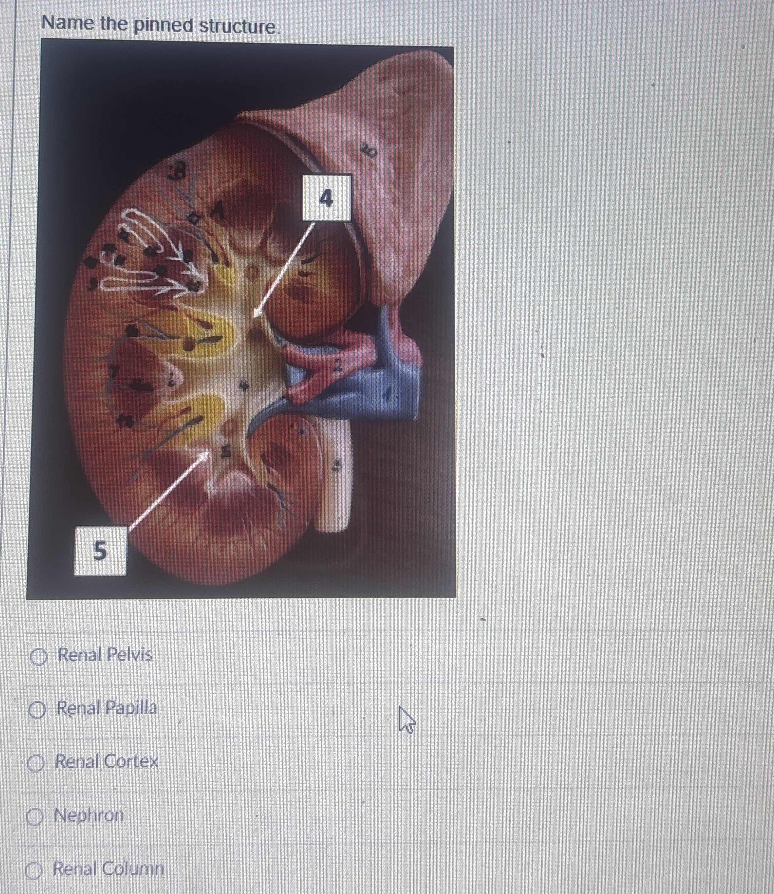 Solved Name the pinned structure.Renal PelvisRenal | Chegg.com