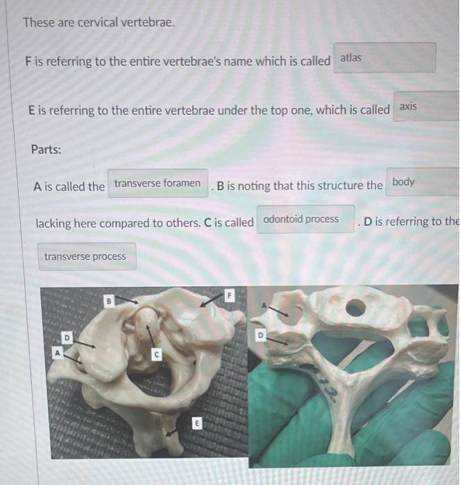 Solved These are cervical vertebrae. Fis referring to the | Chegg.com