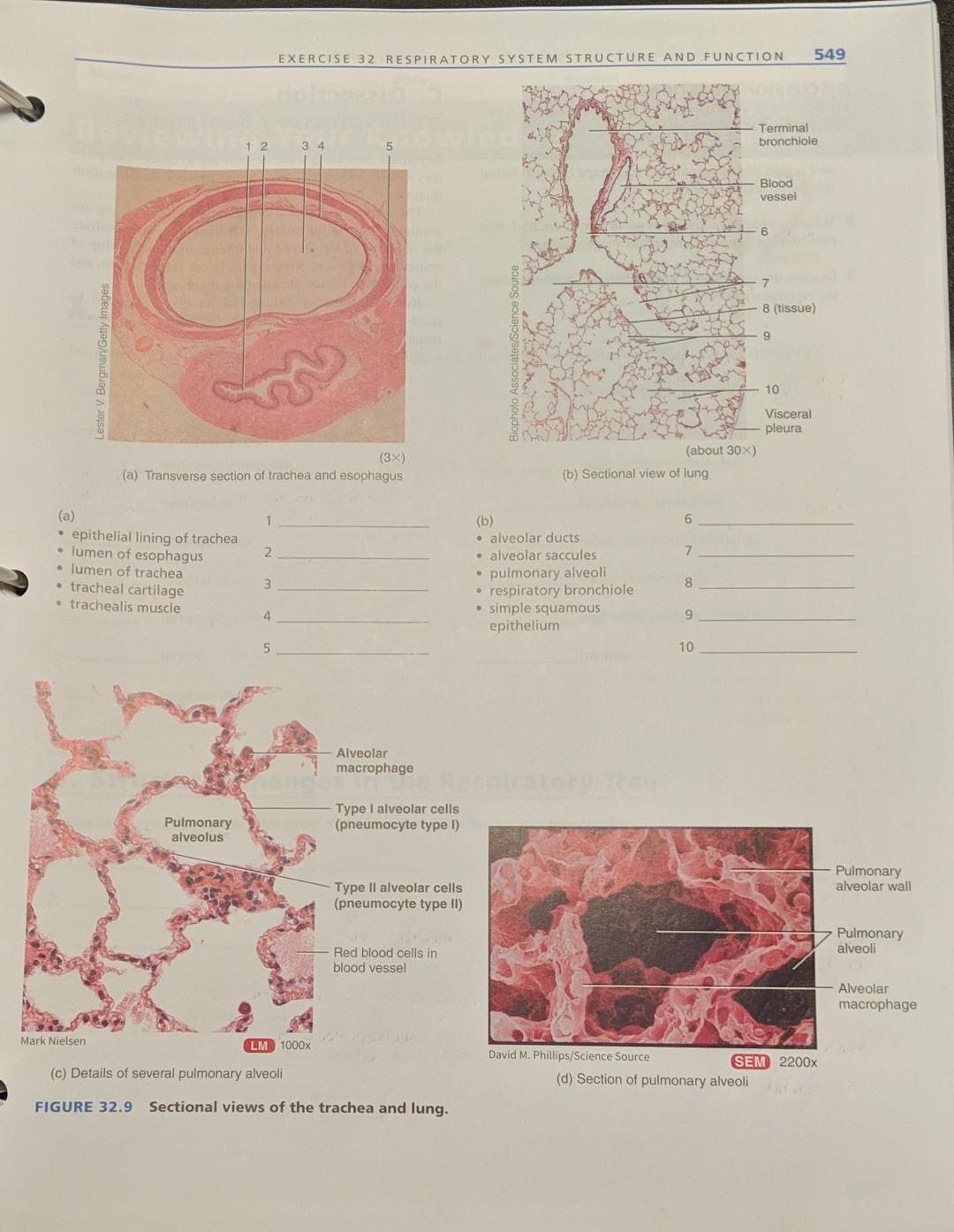 Solved A Transverse Section Of Trachea And Esophagus B