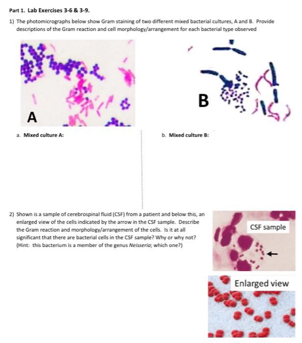 Solved А 4) Shown is an acidfast stain of mixed culture of