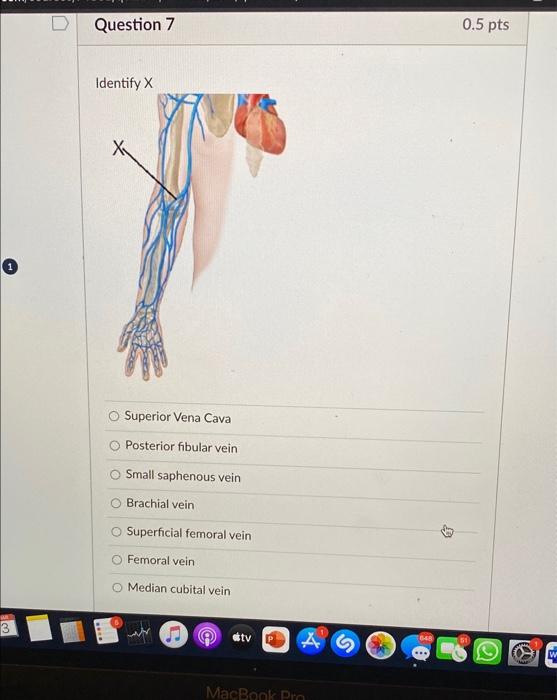 Solved D Question 7 0.5 pts Identify X Х Superior Vena Cava | Chegg.com