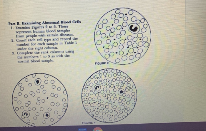 Solved Part B. Examining Abnormal Blood Cells 1. Examine | Chegg.com