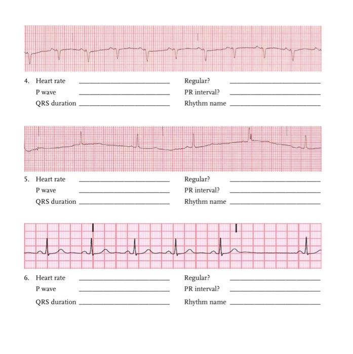 Solved 4. Heart rate Regular? P wave PR interval? QRS | Chegg.com