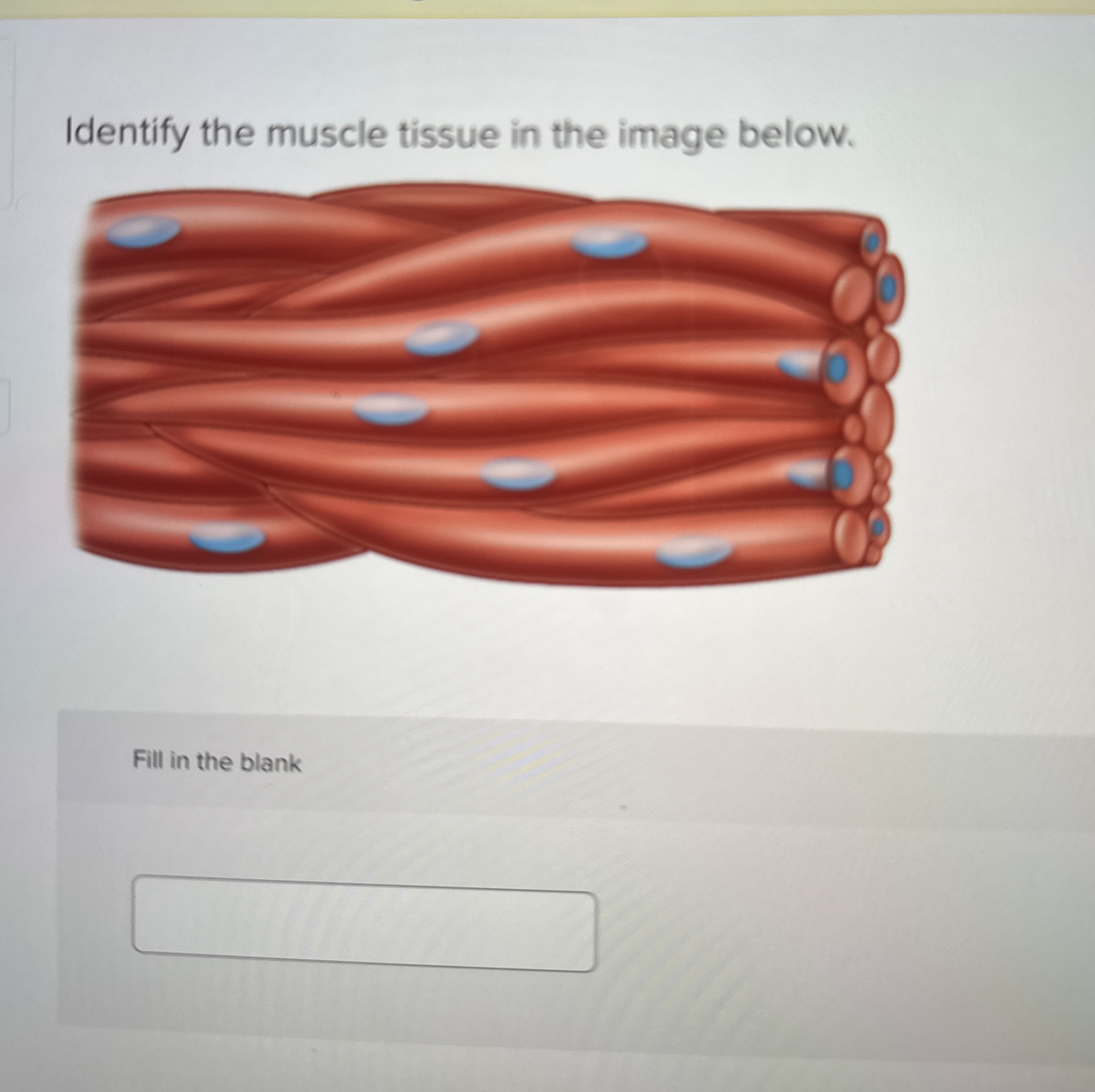 Solved Identify the muscle tissue in the image below.Fill in | Chegg.com