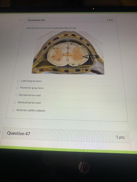 Solved Question 46 1 pts Identity the structure marked by