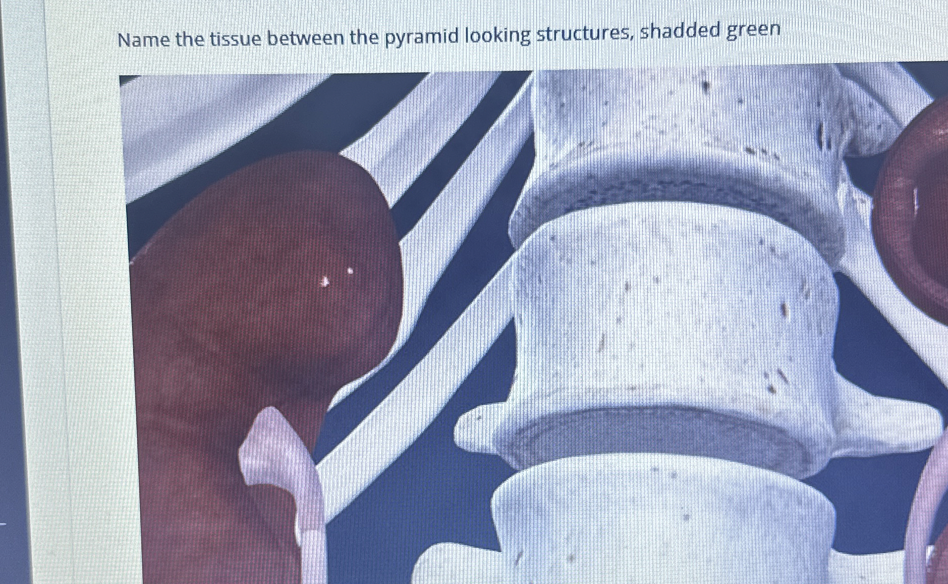 Solved Name the tissue between the pyramid looking | Chegg.com