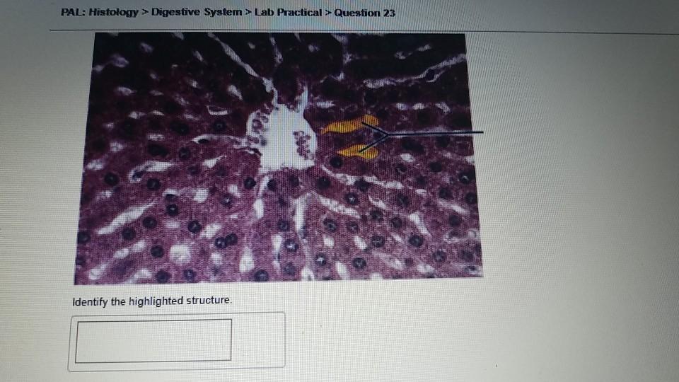 Solved PAL Histology > Digestive System > Lab Practical >