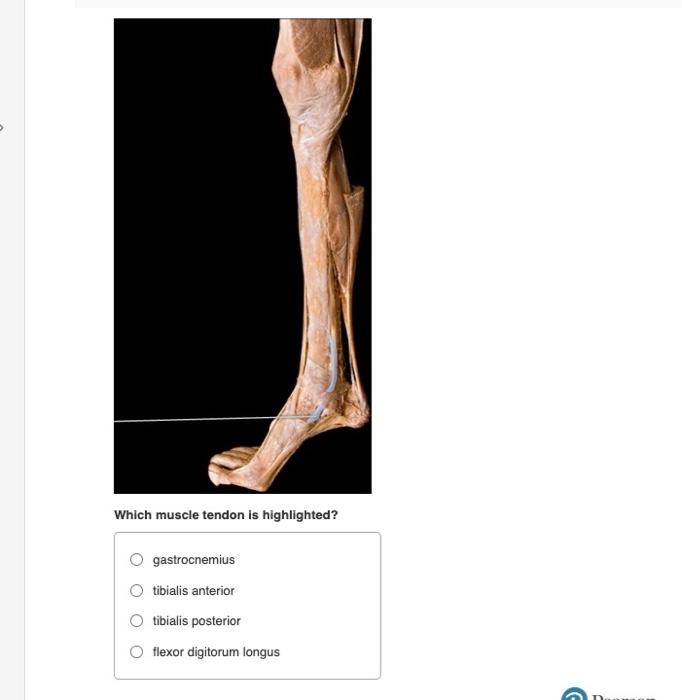 Which muscle tendon is highlighted? gastrocnemius tibialis anterior tibialis posterior flexor digitorum longus