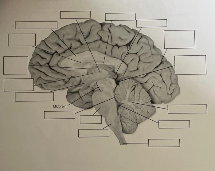 Solved Brainstem Inferior view Midbrain | Chegg.com