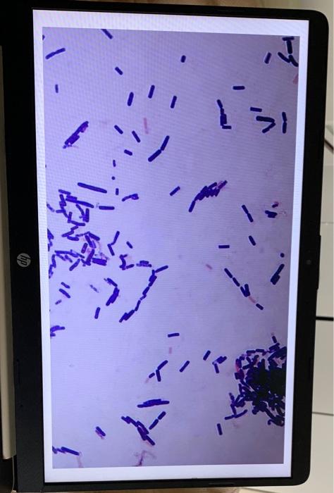 Solved Gram stain process Gram staining steps Cell effects | Chegg.com
