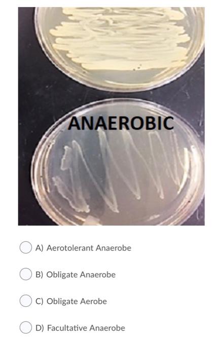 Solved Below is a bacteria that has been cultivated in both