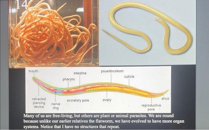 Solved So Mouth Intestine Pharynx Psuedocoleom Cuticle Anus 