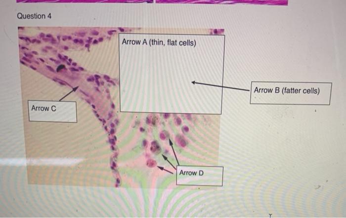 Solved Question 4 Arrow A (thin, flat cells) Arrow B (fatter | Chegg.com