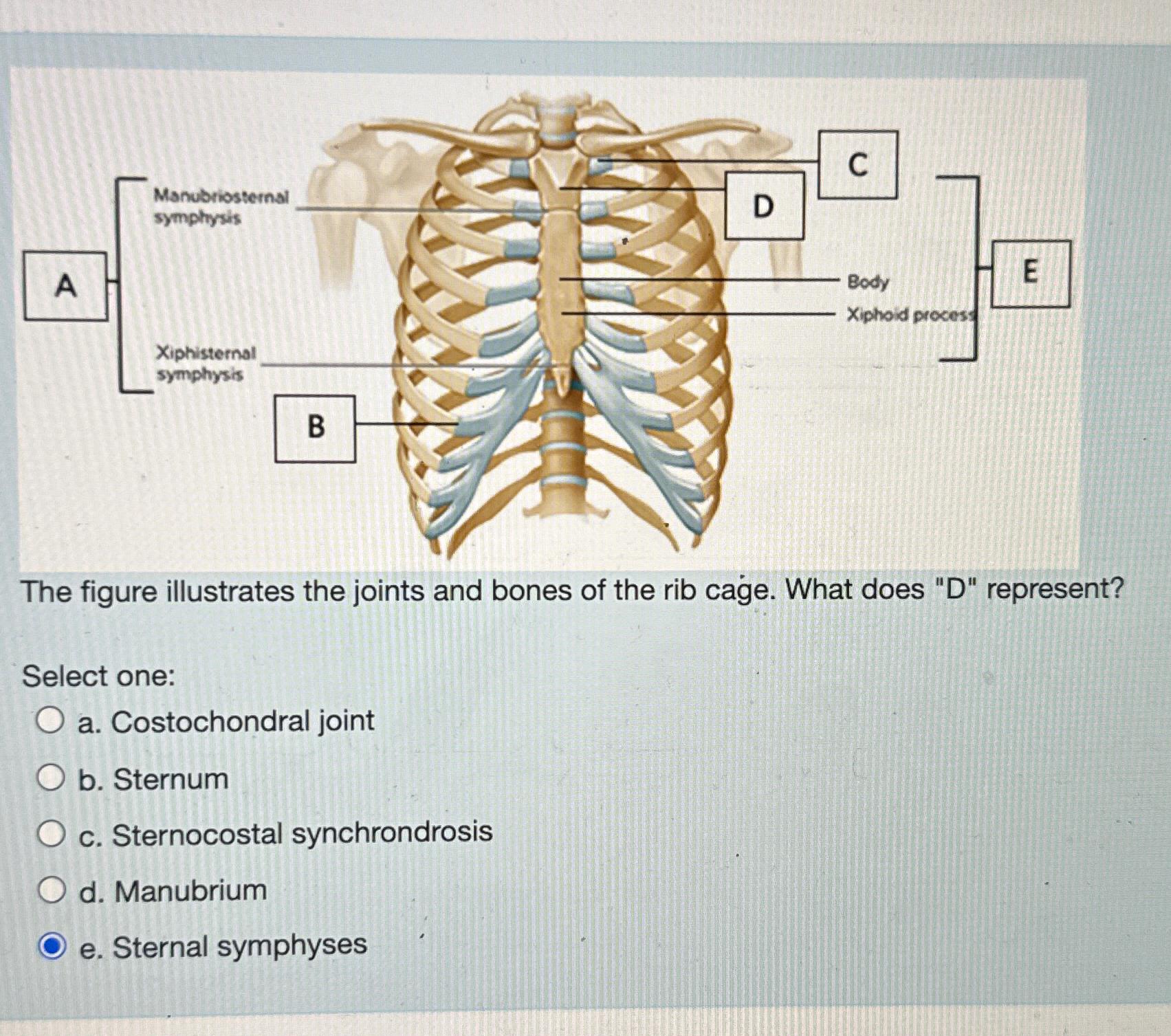 Solved The figure illustrates the joints and bones of the | Chegg.com