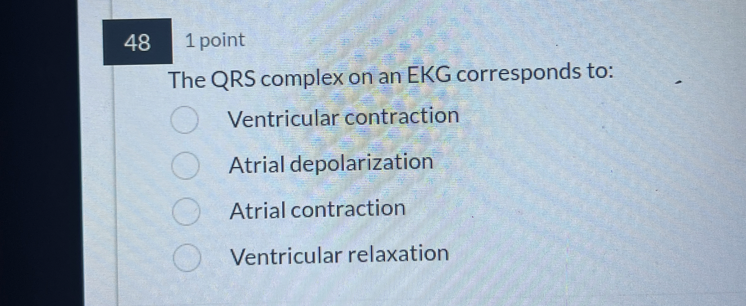 Solved 481 ﻿pointThe QRS complex on an EKG corresponds | Chegg.com