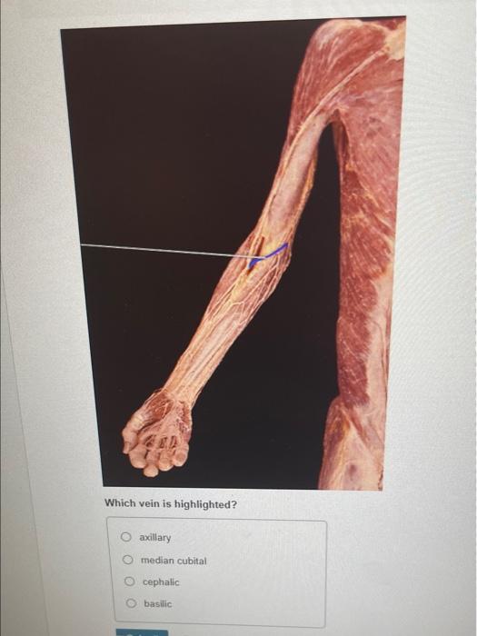 Which vein is highlighted?
axillary
median cubital
cephalic
basilic