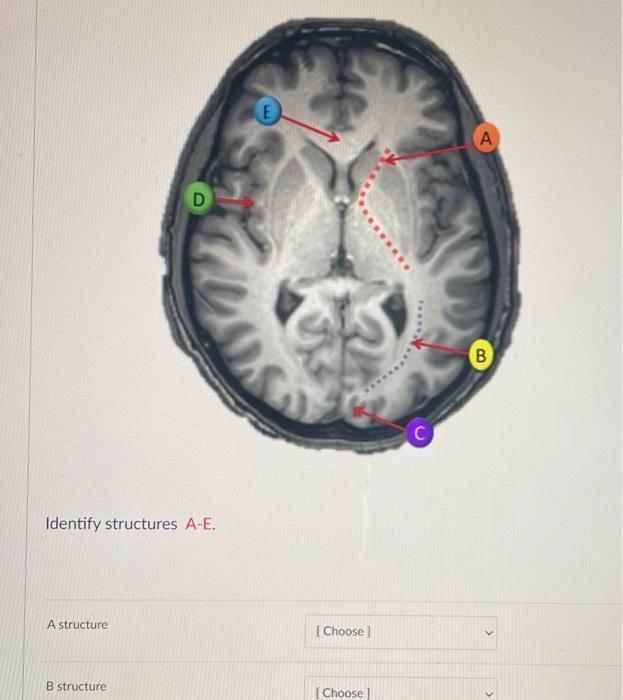 Solved A D (В B C Identify structures A-E. A structure [ | Chegg.com