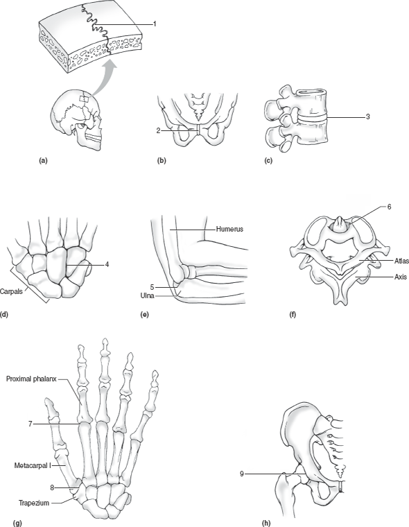 Solved Identify the types of structural and functional joints num