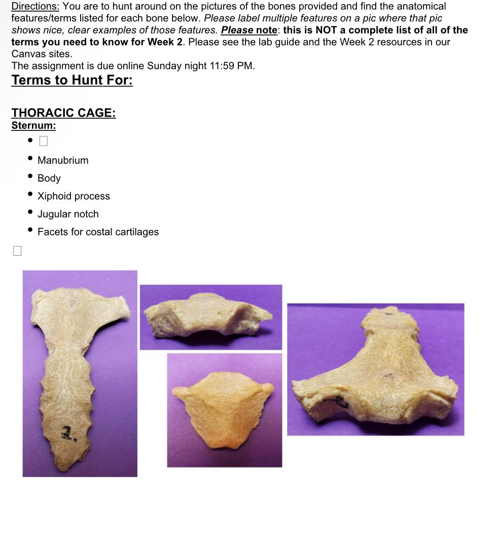 Solved You are to hunt around on the pictures of the bones | Chegg.com
