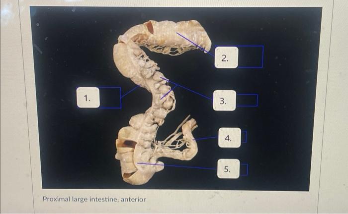 Proximal large intestine, anterior