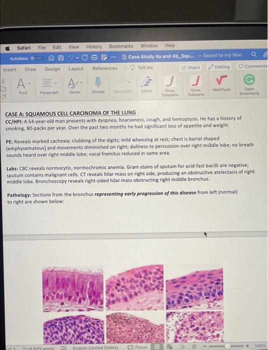 Solved CASE A: SQUAMOUS CELL CARCINOMA OF THE LUNG CC/HPI: A | Chegg.com
