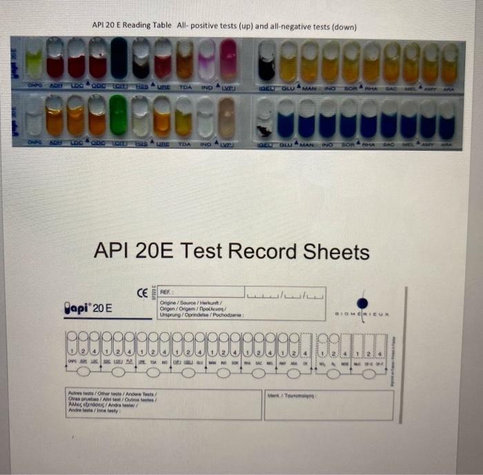 Solved C. Ej. 66 API 20E Look at the following strips | Chegg.com