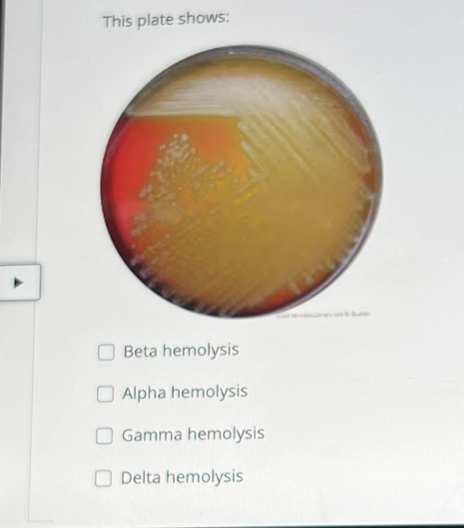 Solved This plate shows:Beta hemolysisAlpha hemolysisGamma | Chegg.com