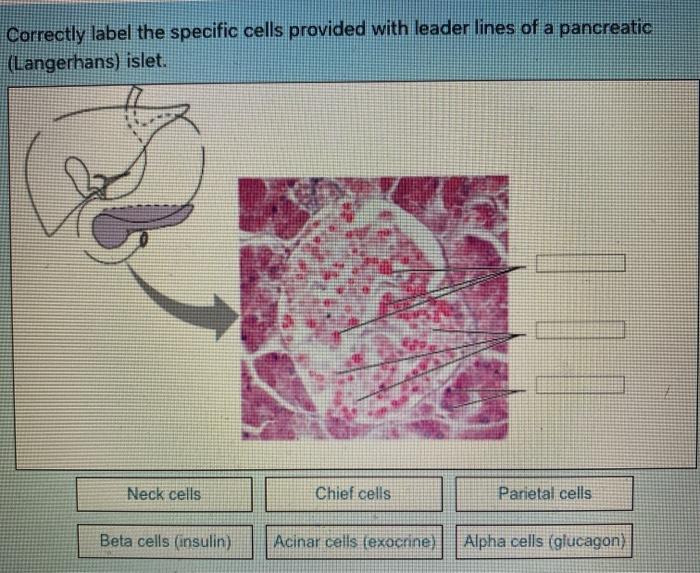 Solved Villus Simple columnar epithelium Lamina propria | Chegg.com