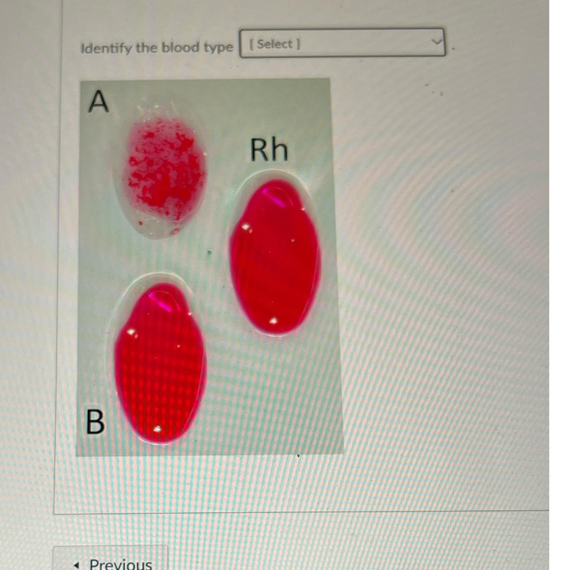 Solved Identify the blood typeARhB | Chegg.com