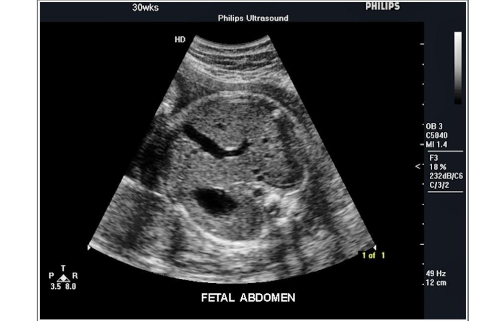 Solved Each ultrasound image has a part of the fetal Biology Diagrams