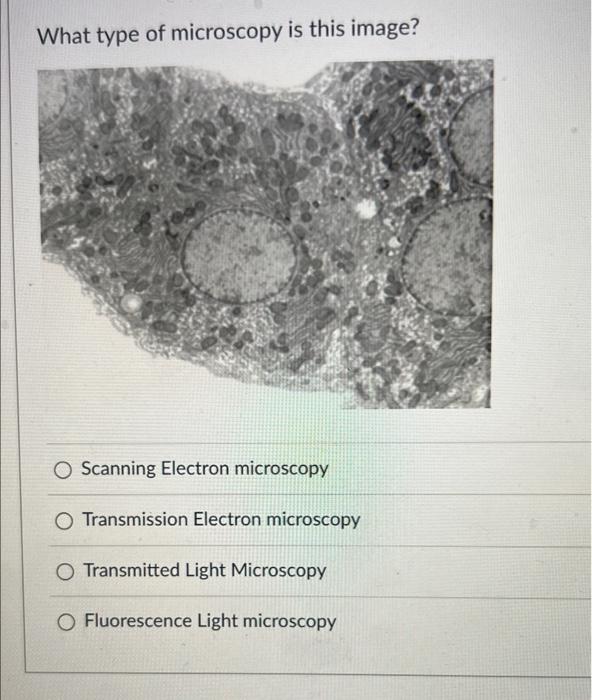 What type of microscopy is this image?
Scanning Electron microscopy
Transmission Electron microscopy
Transmitted Light Micros