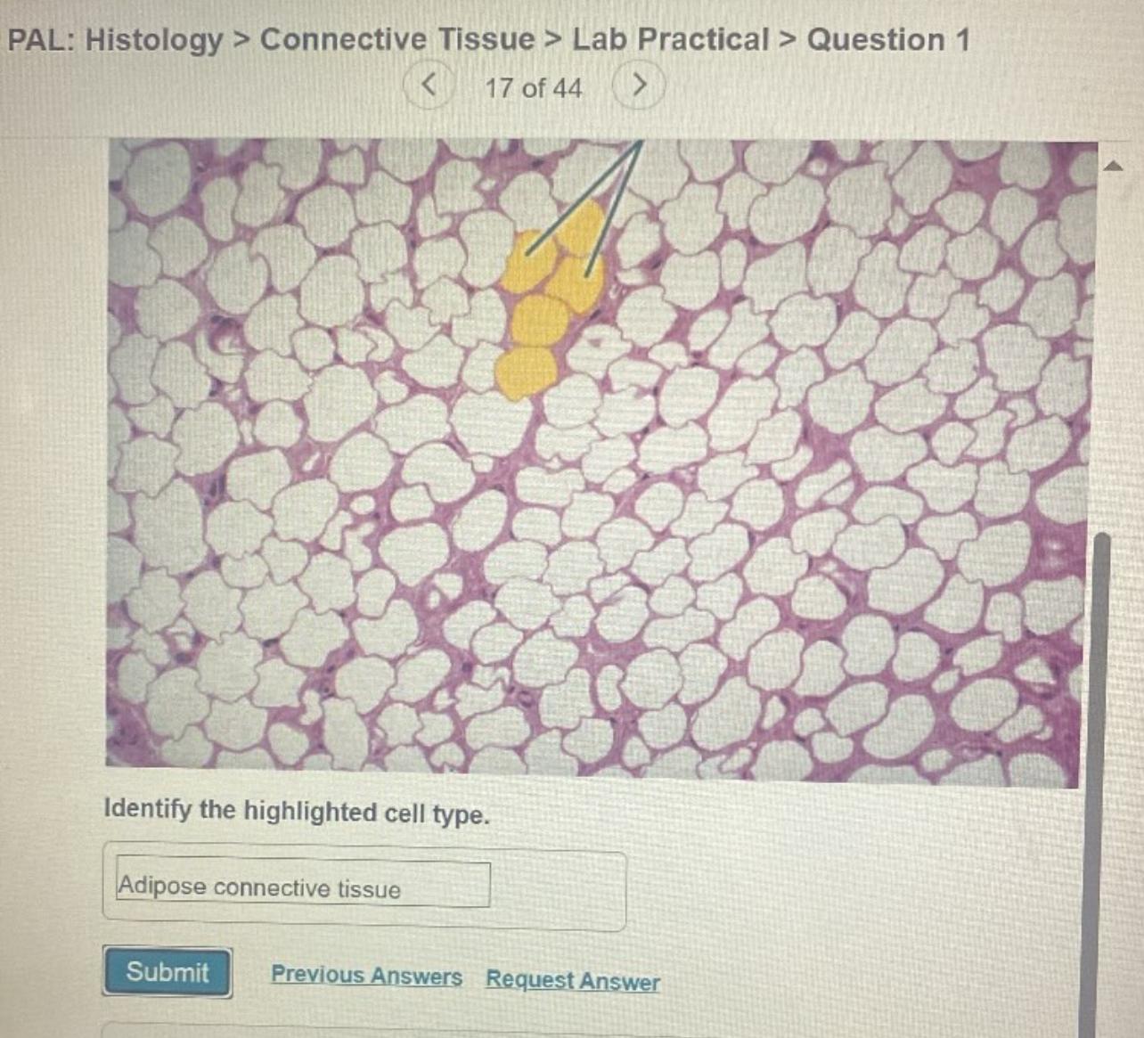 Solved PAL: Histology &gt; ﻿Connective Tissue &gt; ﻿Lab Practical | Chegg.com
