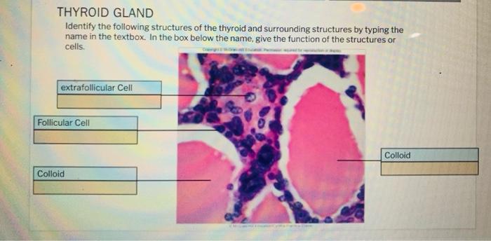 Solved PANCREAS Identify the following structures of the | Chegg.com