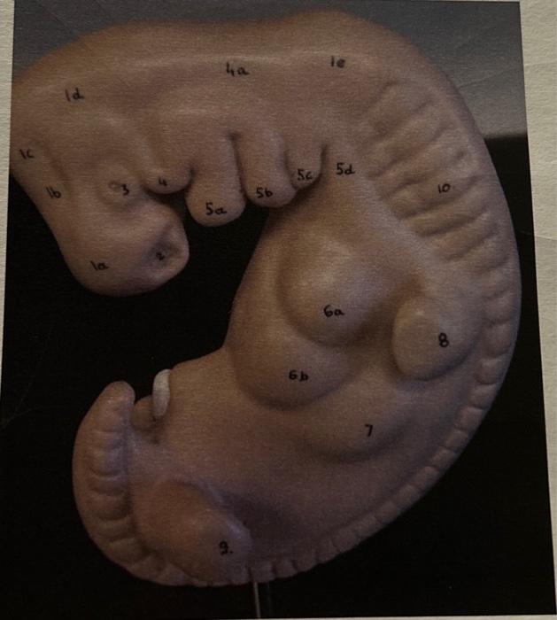 Label the features of the developing embryo: | Chegg.com