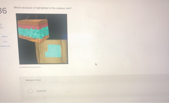 solved-which-structure-is-highlighted-in-the-cadaver-skin-chegg