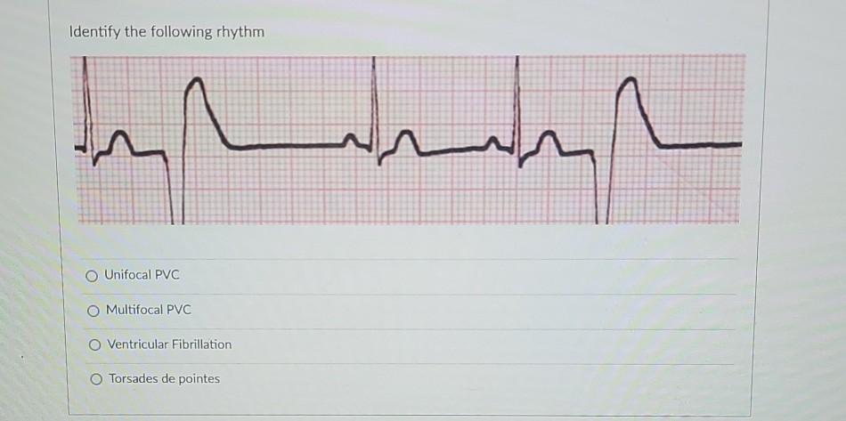 Solved Identify the following rhythm الامام Unifocal PVC O | Chegg.com