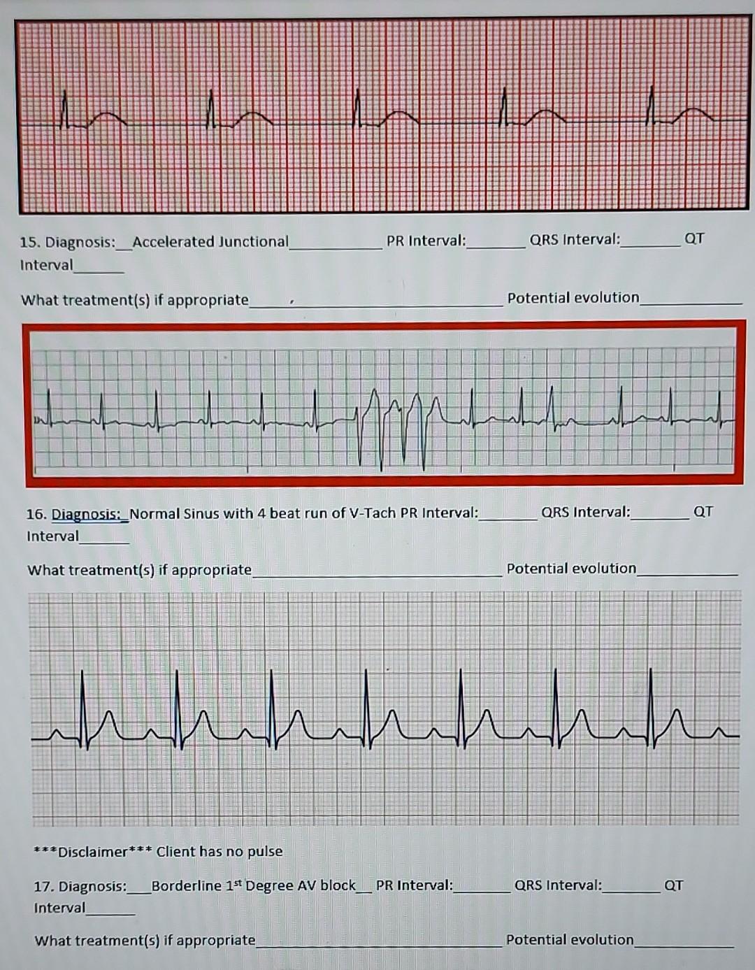 Solved PR Interval: QRS Interval: QT 15. Diagnosis: | Chegg.com