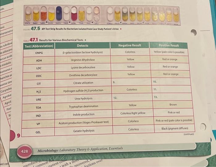 nGuar 47.5 ApI Test Strip Results for Bacterium