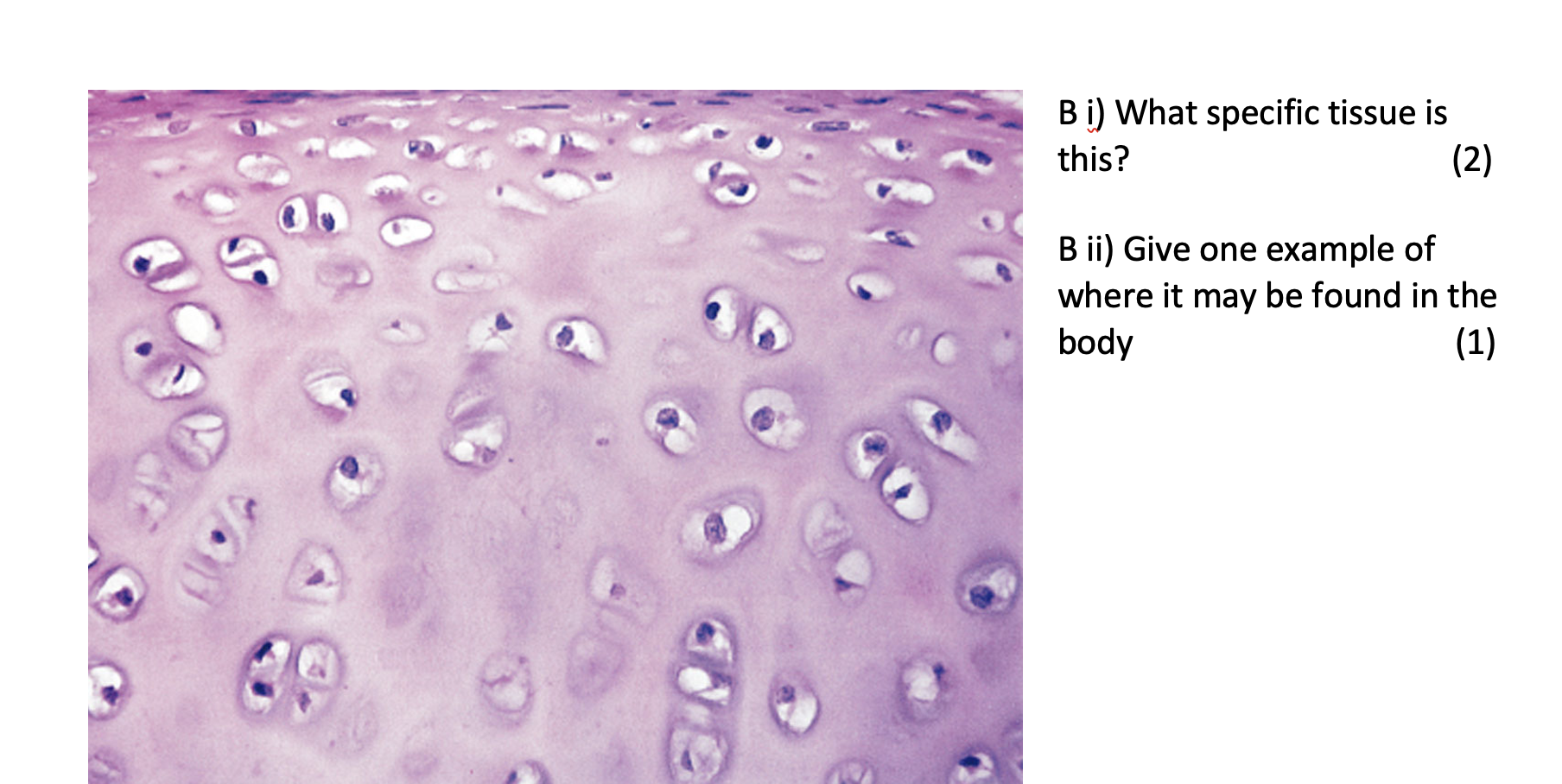 Solved 7. ﻿Identify The 2 ﻿tissues Shown Below And Give One | Chegg.com