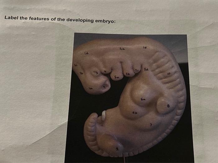 Label the features of the developing embryo: | Chegg.com