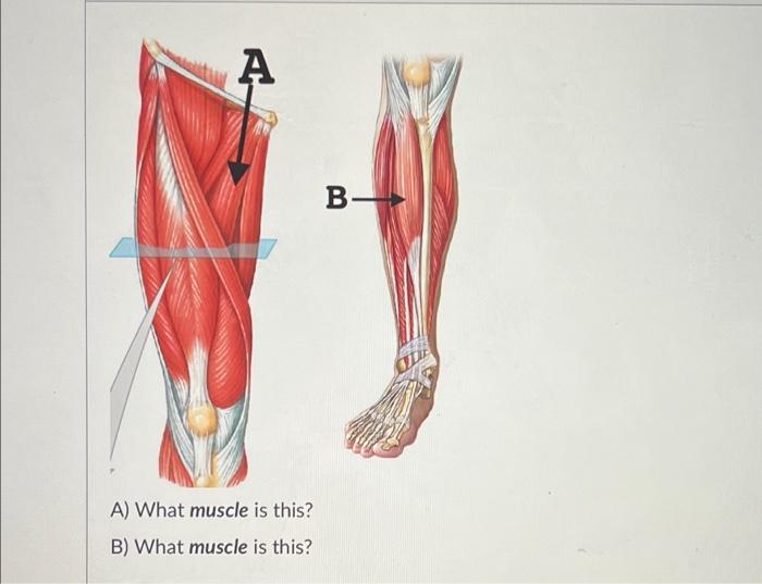 Solved A B- A) What Muscle Is This? B) What Muscle Is This? | Chegg.com