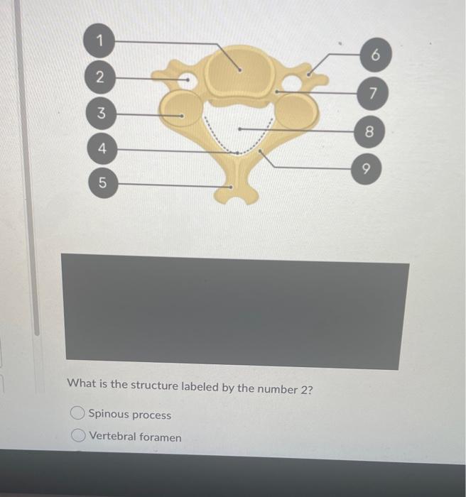 Solved Identify this structure. (Hint: On the outside of the | Chegg.com