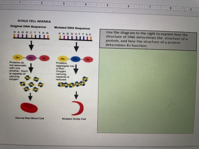 Solved 2-3 4 5 6 SICKLE CELL ANEMIA Original DNA Sequence | Chegg.com